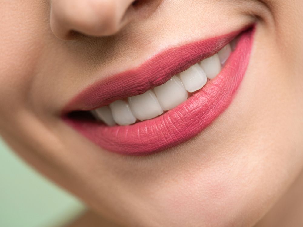 Teeth Whitening